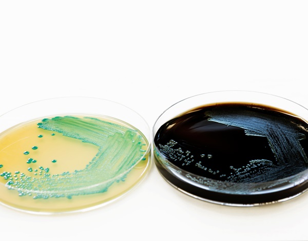 food-safety-pathogen-listeria-monocytogenes-isolated-on-agar-from-a-food-sample_600-x-469-px
