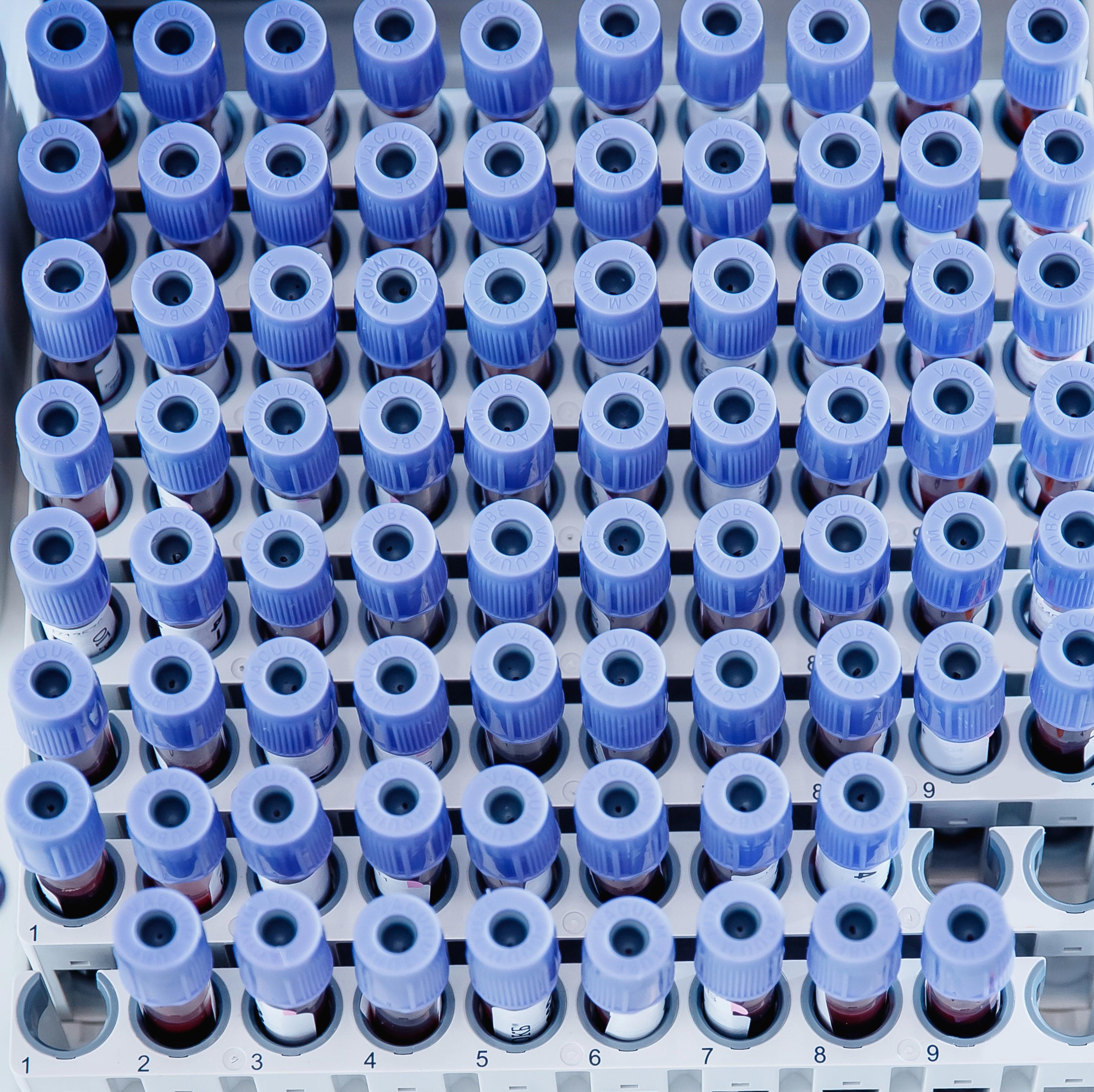 blood-test-tube-laboratory-for-analysis-with-virus-epidemic_-9198-x-5407-px (1)