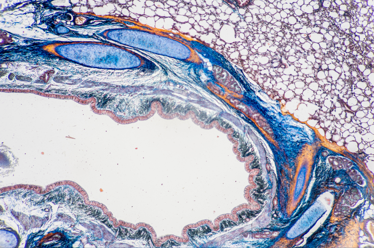 pathology-picture