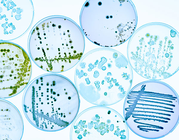 petri-dishes_600x470px